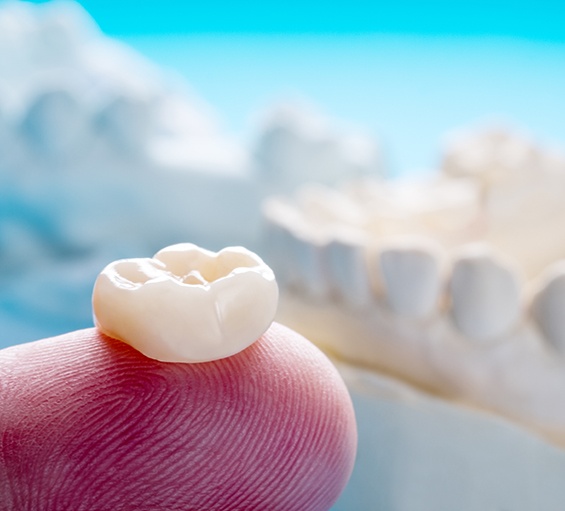 A closeup of a dental crown sitting on a person’s finger
