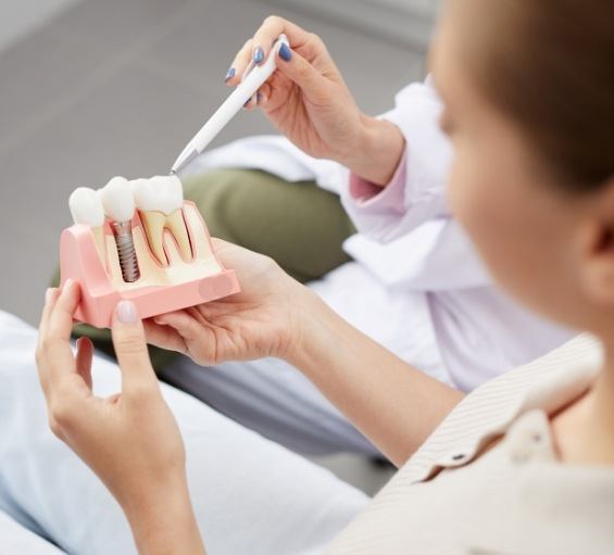 Dentist showing a dental implant model to a patient