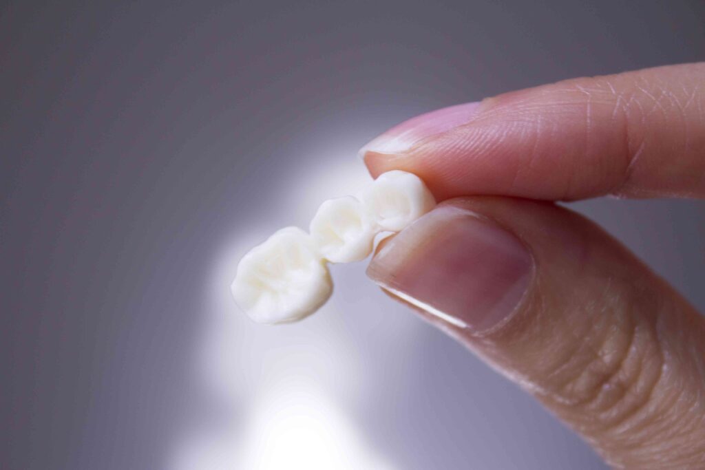 Closeup of a dental bridge