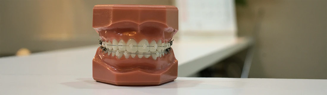 FC – Clear Braces in Windham, ME – Roosevelt Dental FC – Clear Braces in Windham, ME – Roosevelt Dental